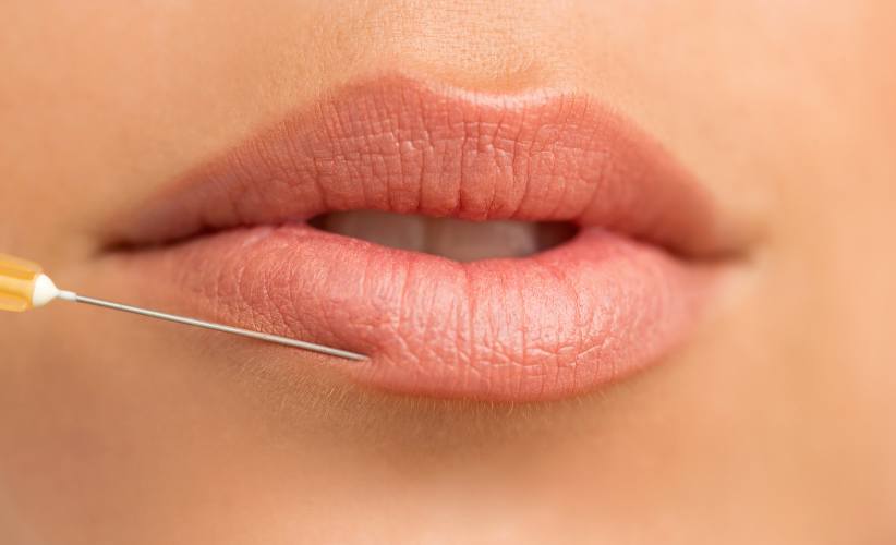 preguntas-frecuentes-aumento-de-labios-clinicasdh